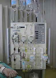 LDLアフェレーシスの治療装置の写真です。